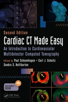Cardiac CT Made Easy
