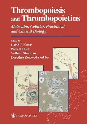Thrombopoiesis and Thrombopoietins