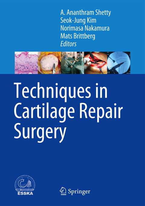 Techniques in Cartilage Repair Surgery - 