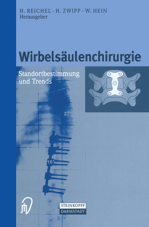 Wirbelsäulenchirurgie - 