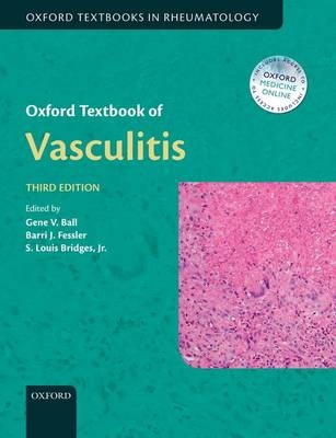 Oxford Textbook of Vasculitis - 