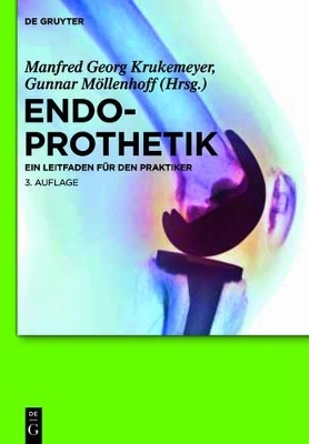 Endoprothetik