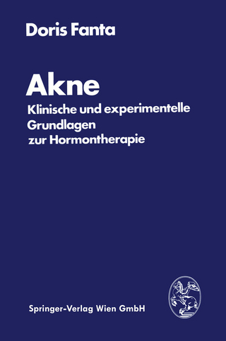 Akne