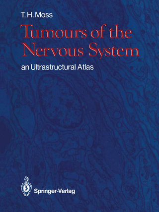 Tumours of the Nervous System