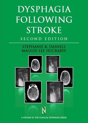 Dysphagia Following Stroke