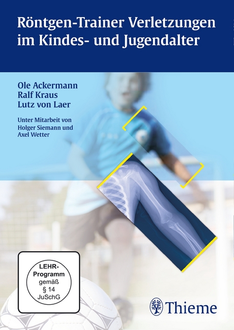 R&ouml;ntgen-Trainer Verletzungen im Kindes- und Jugendalter - Ole Ackermann, Ralf Kraus, Lutz Von Laer