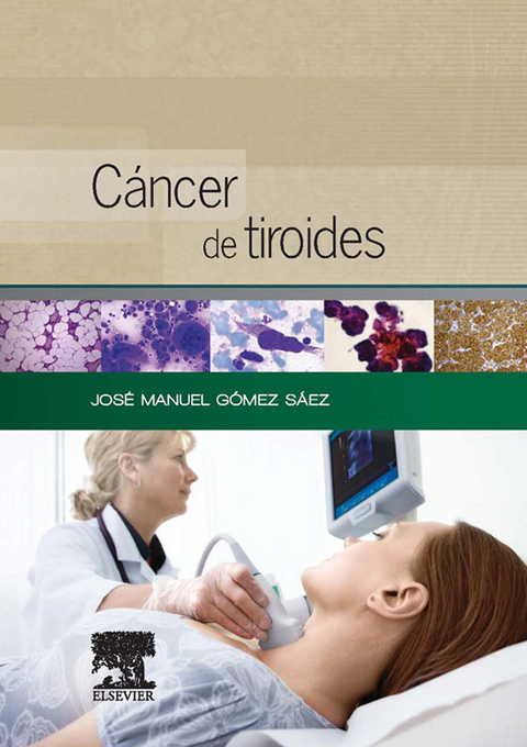 C&aacute;ncer de tiroides - 