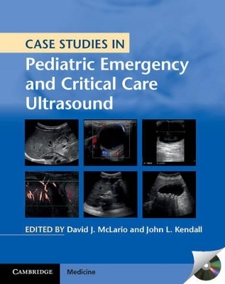 Case Studies in Pediatric Emergency and Critical Care Ultrasound with DVD-ROM - 