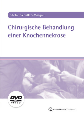 Chirurgische Behandlung einer Knochennekrose