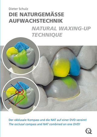 Die naturgemäße Aufwachstechnik / Natural Waxing‑Up Technique