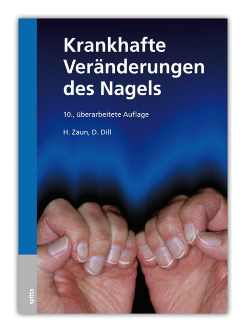 Krankhafte Ver&auml;nderungen des Nagels - Hansotto Zaun, Dorothee Dill