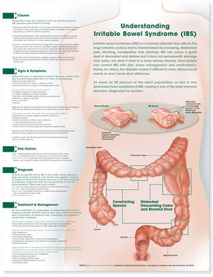 Understanding Irritable Bowel Syndrome Anatomical Chart