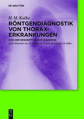R&ouml;ntgendiagnostik von Thoraxerkrankungen - H. M. Kulke