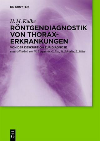 Röntgendiagnostik von Thoraxerkrankungen