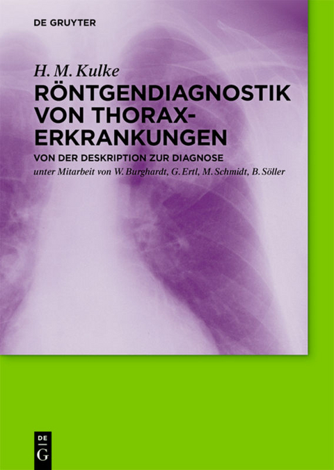 R&ouml;ntgendiagnostik von Thoraxerkrankungen - H. M. Kulke