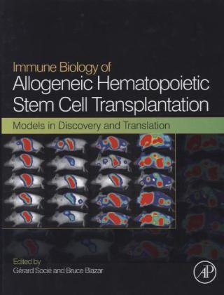 Immune Biology of Allogeneic Hematopoietic Stem Cell Transplantation - 