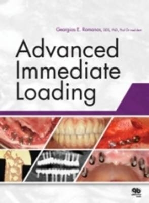 Advanced Immediate Loading