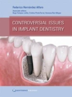 Controversial Issues in Implant Dentistry