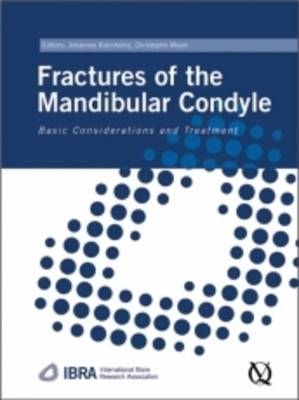 Fractures of the Mandibular Condyle