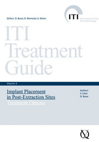 Implant Placement in Post-Extraction Sites