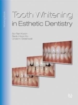 Tooth Whitening in Esthetic Dentistry - So-Ran Kwon, Seok-Hoon Ko