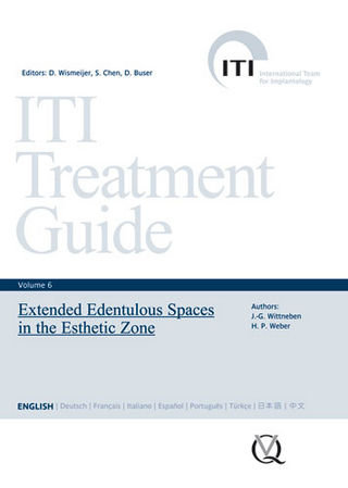 Extended Edentulous Spaces in the Esthetic Zone