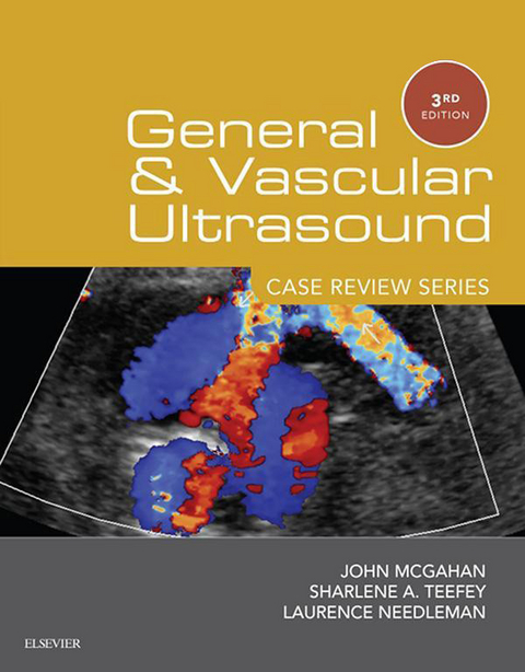 General and Vascular Ultrasound: Case Review Series E-Book -  John P. McGahan,  Laurence Needleman,  Sharlene A Teefey