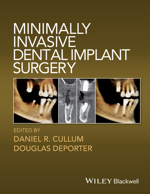 Minimally Invasive Dental Implant Surgery - 