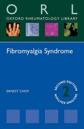 Fibromyalgia Syndrome -  Ernest Choy