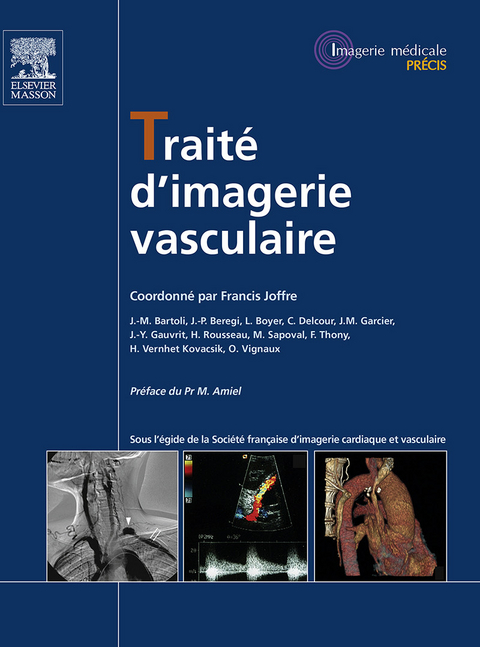 Traite d'imagerie vasculaire -  Francis Joffre