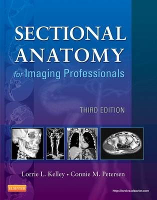 Sectional Anatomy for Imaging Professionals - Pageburst E-Book on Kno