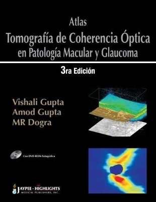 Atlas – Tomografía de Coherencia Óptica en Patología Macular y Glaucoma