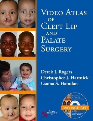 Video Atlas of Cleft Lip and  Palate Surgery - 