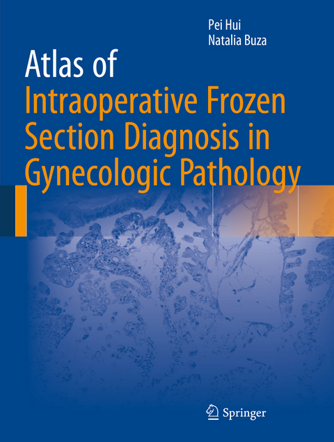 Atlas of Intraoperative Frozen Section Diagnosis in Gynecologic Pathology - Pei Hui, Natalia Buza