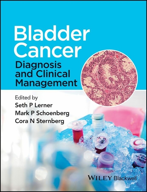 Bladder Cancer - 