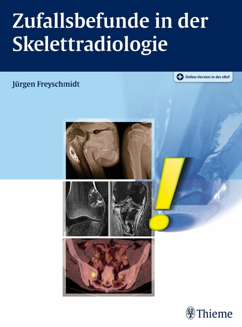 Zufallsbefunde in der Skelettradiologie -  J&uuml;rgen Freyschmidt