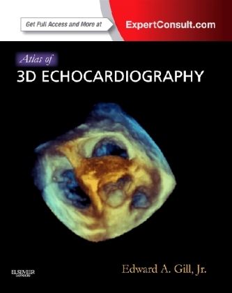 Atlas of 3D Echocardiography - Edward A. Gill