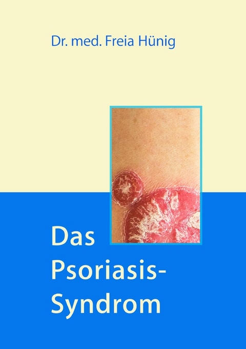 Das Psoriasis-Syndrom - Dr. Freia H&uuml;nig