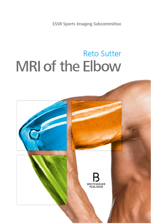 MRI of the Elbow - 