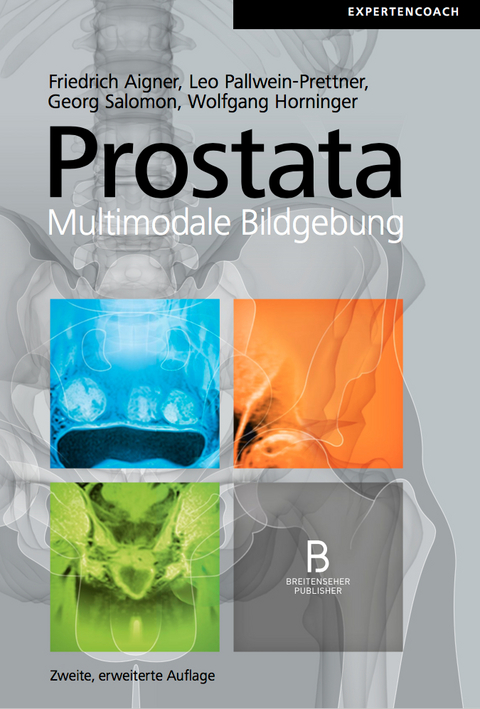Prostata &ndash; Multimodale Bildgebung - 
