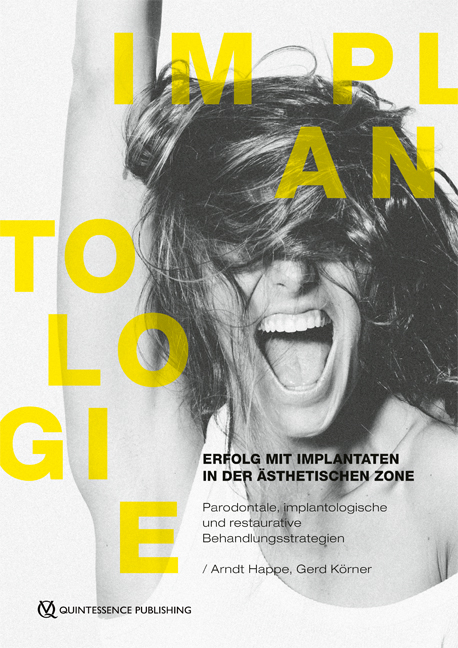 Erfolg mit Implantaten in der &auml;sthetischen Zone - Arndt Happe, Gerd K&ouml;rner