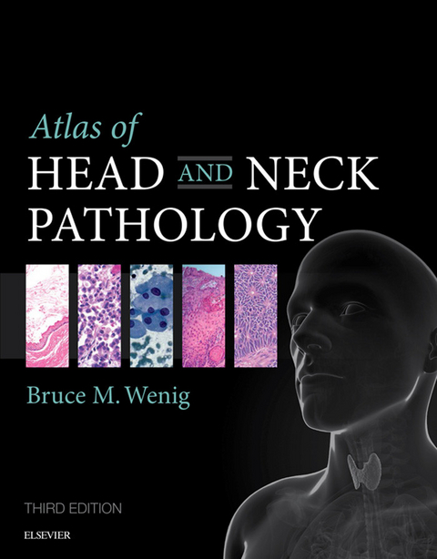 Atlas of Head and Neck Pathology -  Bruce M. Wenig