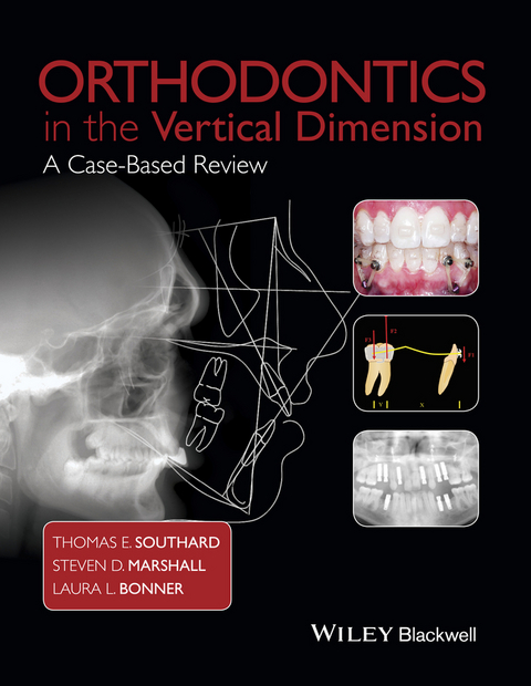 Orthodontics in the Vertical Dimension -  Laura L. Bonner,  Steven D. Marshall,  Thomas E. Southard