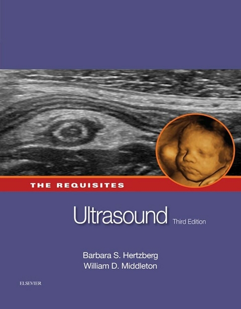 Ultrasound: The Requisites -  Barbara S. Hertzberg,  William Dana Middleton