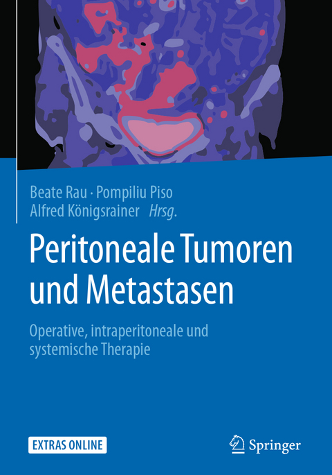 Peritoneale Tumoren und Metastasen - 