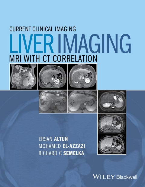 Liver Imaging - 