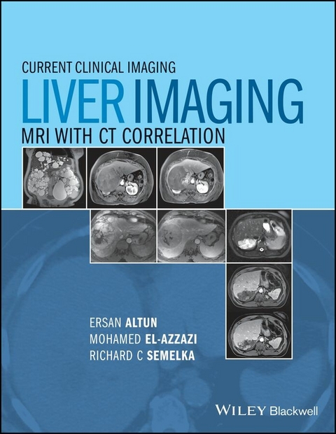 Liver Imaging - 