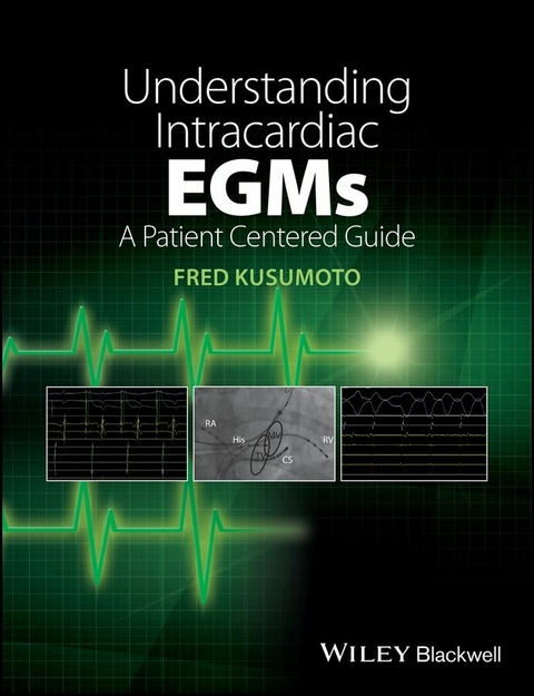 Understanding Intracardiac EGMs -  Fred M. Kusumoto
