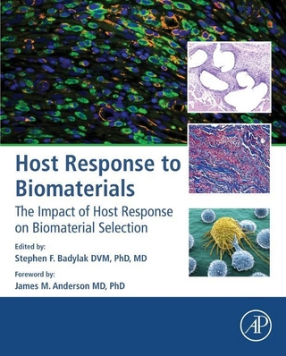 Host Response to Biomaterials