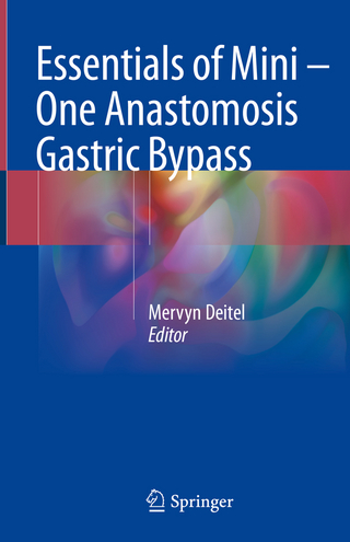 Essentials of Mini — One Anastomosis Gastric Bypass